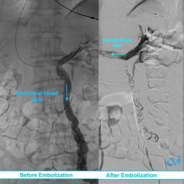 F433CE6E AFF4 4600 83DB 646AEDB2753C 2