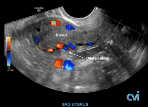 US-1-e1601266887933-300x217