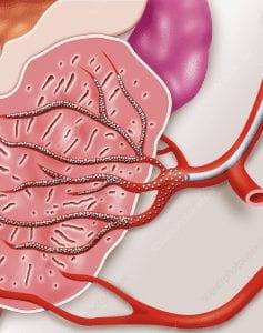 Prostate Artery Embolization