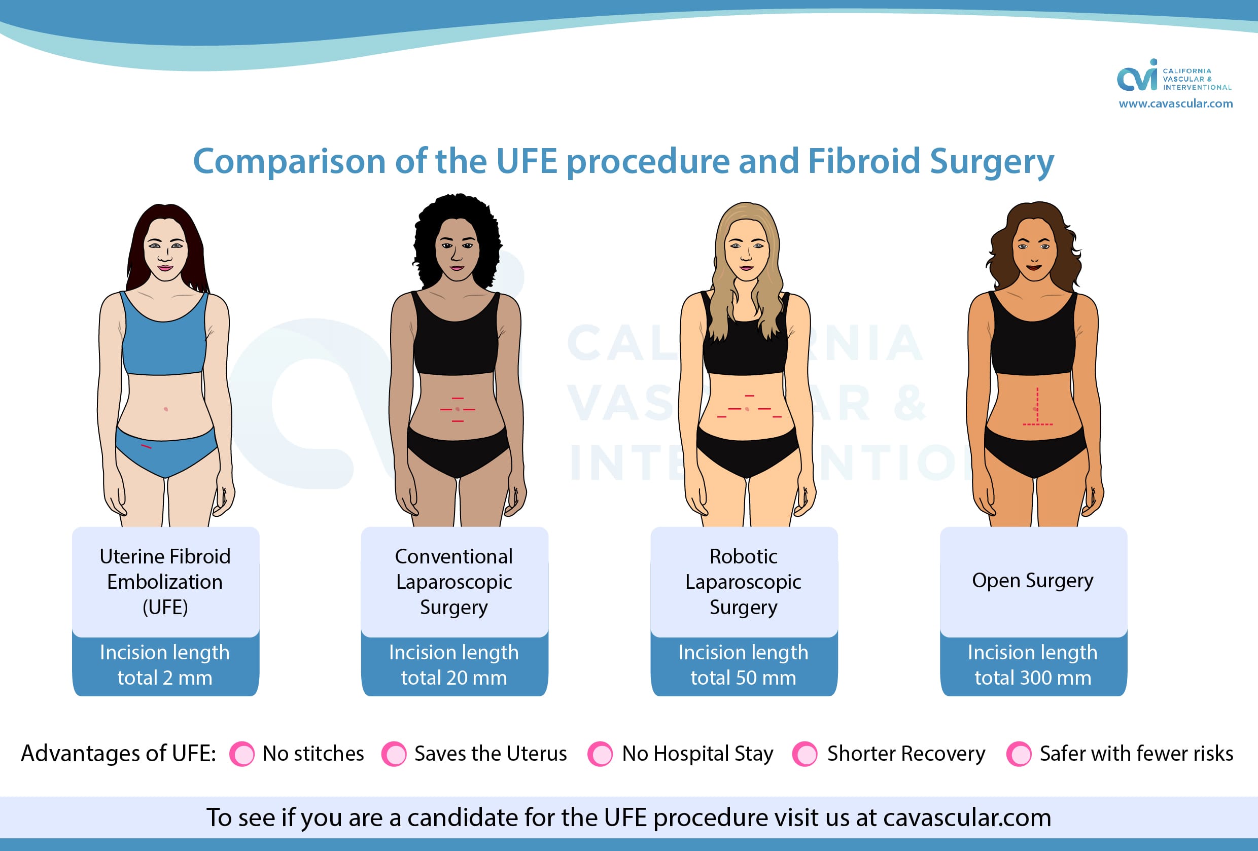 Myomectomy vs Hysterectomy vs Fibroid Embolization Scars