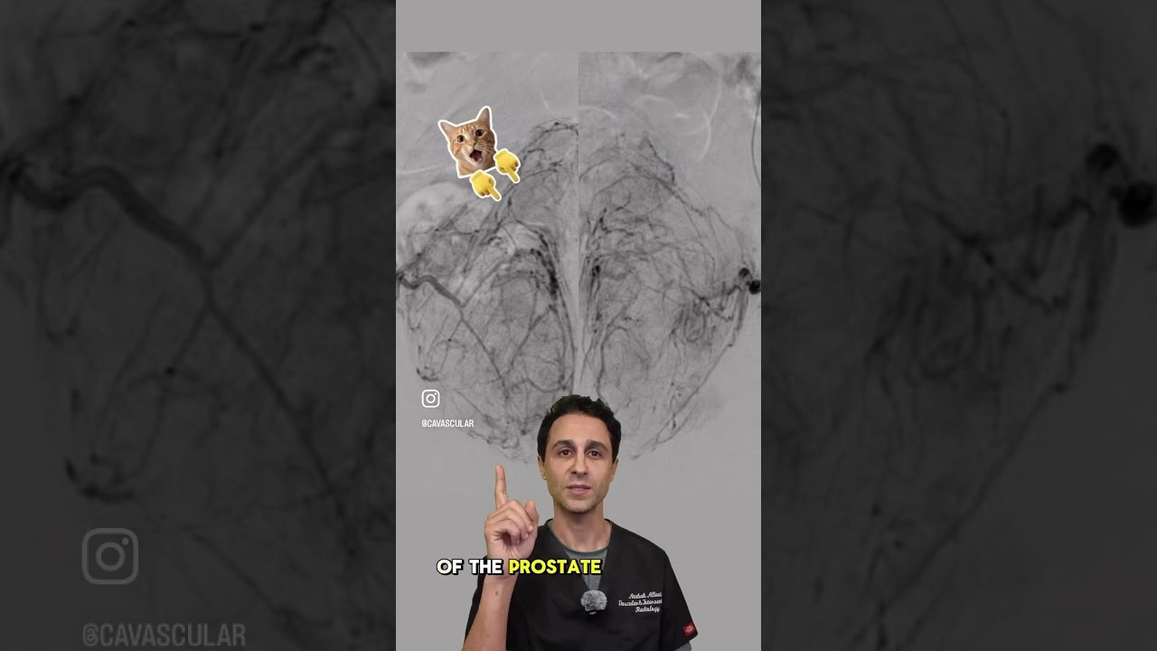 KkvEI0sOPYg HD 1