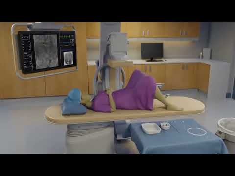Fallopian Tube Recanalization 2 11