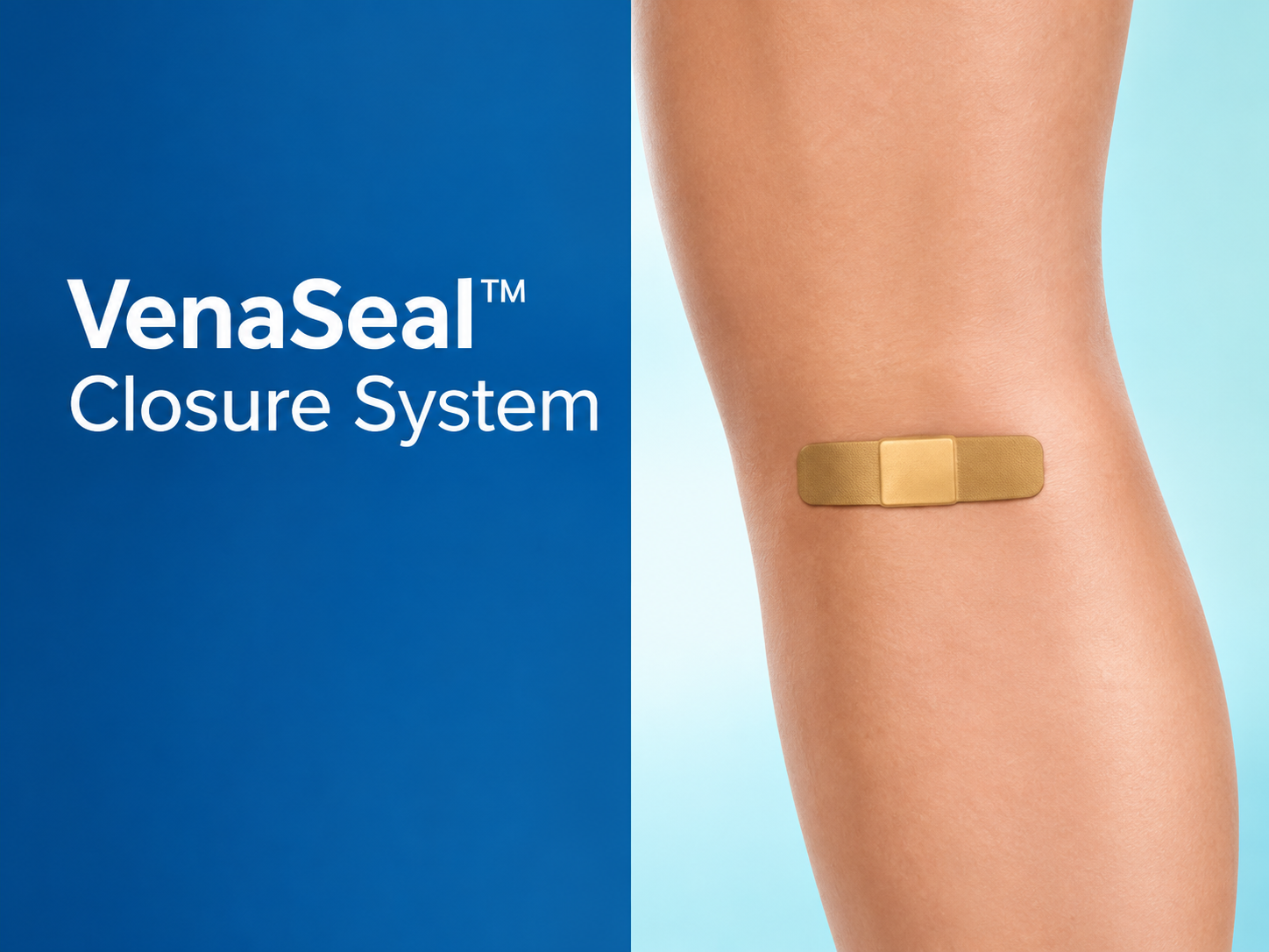 Varicose Veins 6 VenaSeal Closure System Leg Device